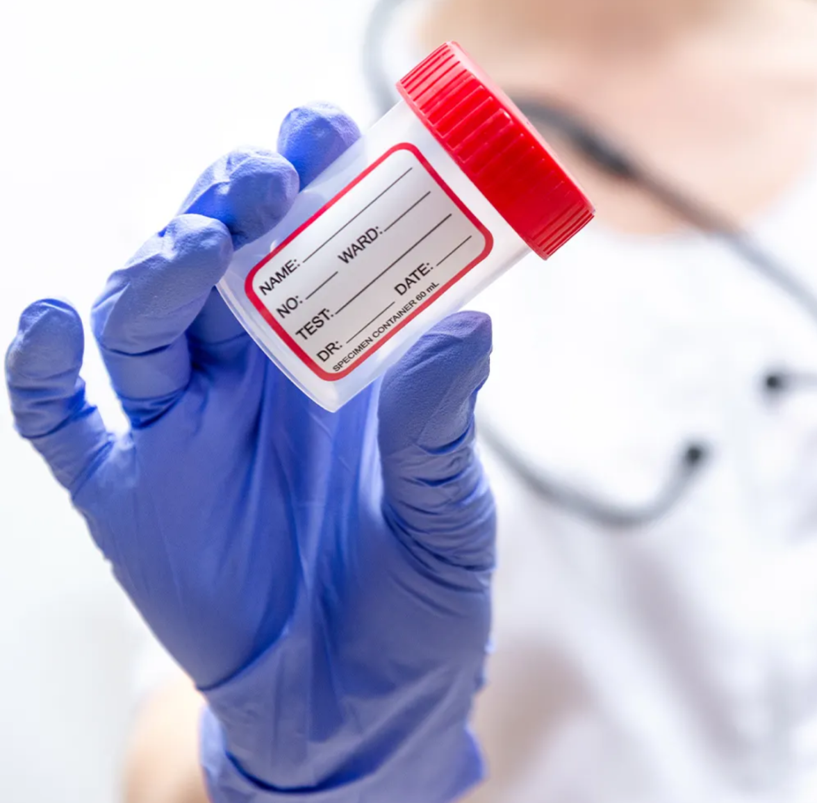 Doctor holding specimen container-Fast & Easy Mobile Labs